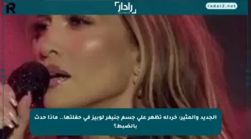 الجديد والمثير: خردلة تظهر على جسم جنيفر لوبيز في حفلتها.. ماذا حدث بالضبط؟